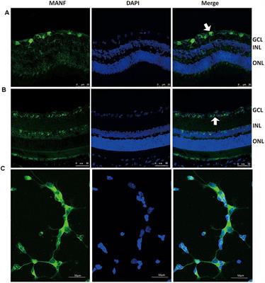Identification of Mesencephalic Astrocyte-Derived Neurotrophic Factor as a Novel Neuroprotective Factor for Retinal Ganglion Cells